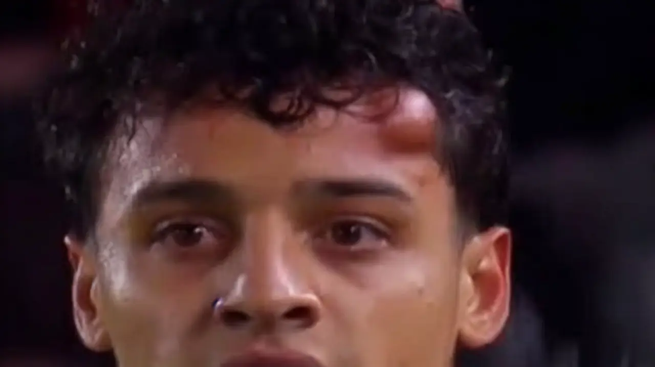 Palacios salió golpeado y con un fuerte moretón en el empate de Estudiantes ante Universidad Católica